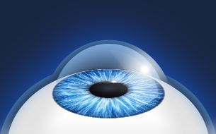 �帲���� ����1