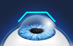 �帲���� ����2