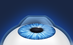 �帲���� ����4