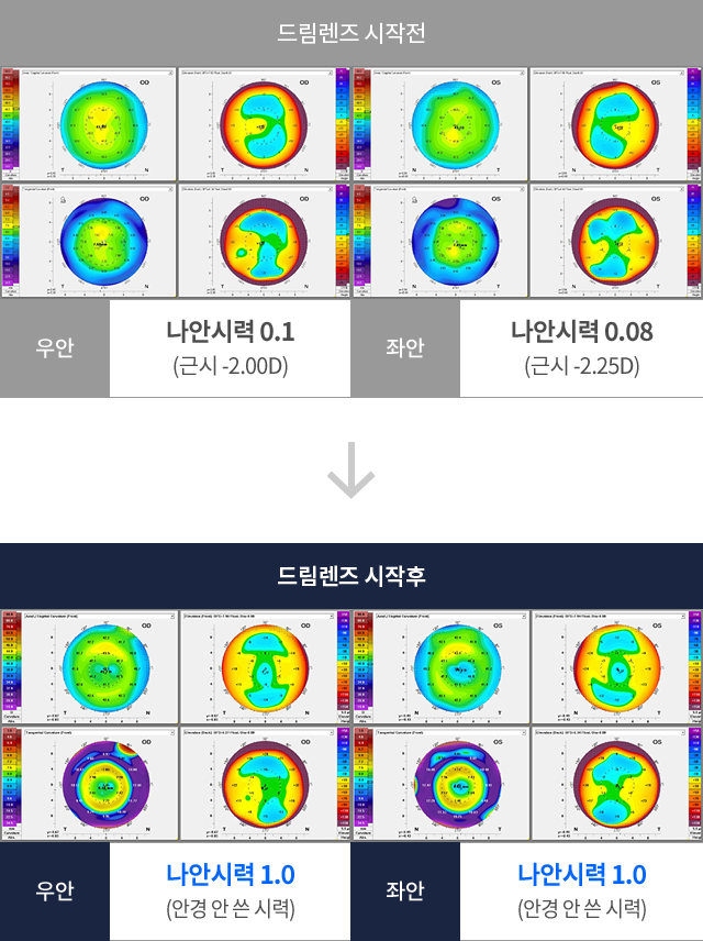 �帲���� ó�� ���