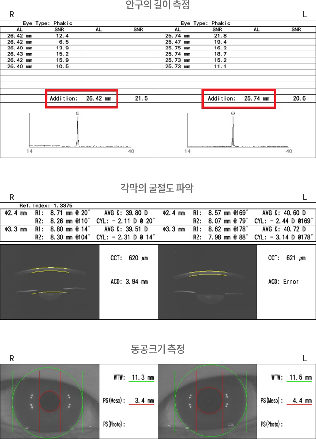 ���̻���Ʈ ó�� ���